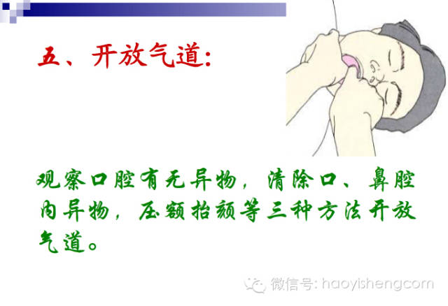 心肺复苏ppt课件免费下载,新生儿心肺复苏ppt课件