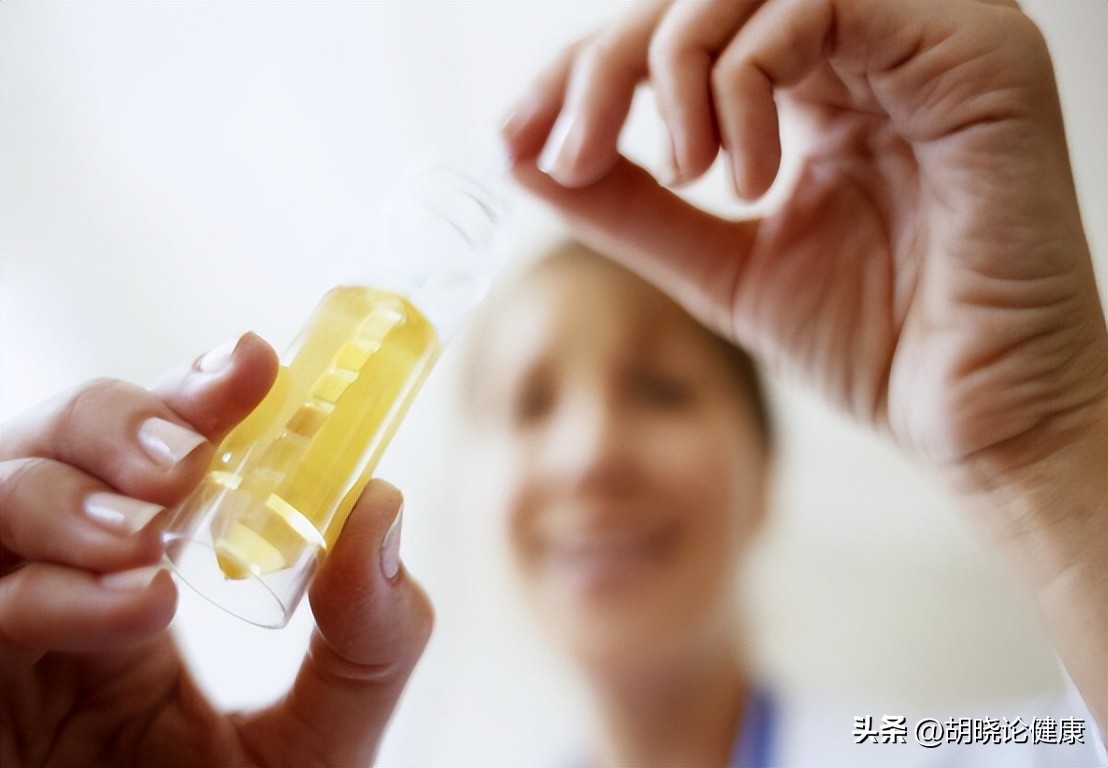 狼疮肾炎补体c4低是狼疮复发吗,狼疮性肾炎诊断的特异性抗体指标