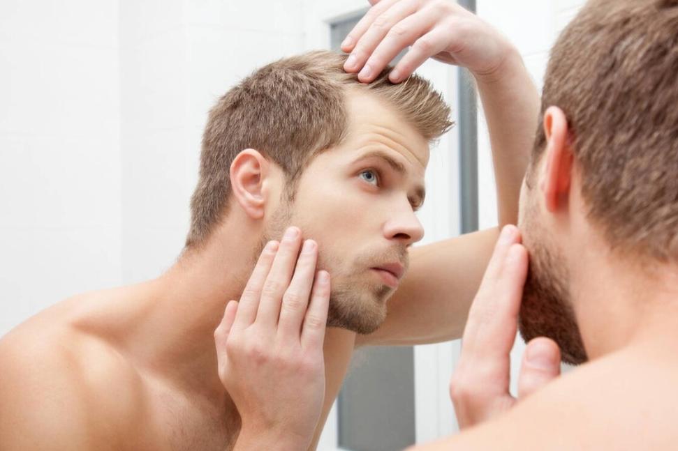 男性体内雄性激素越旺盛就越好吗？提醒：雄激素旺盛或会导致脱发