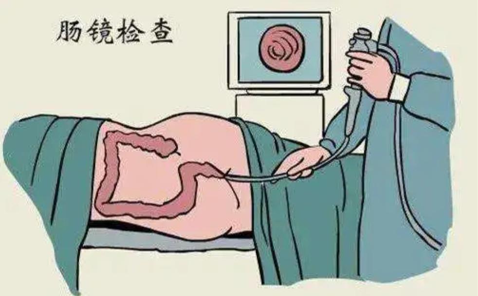 男医生给女朋友做肠镜,有男医生给女性做肠镜吗
