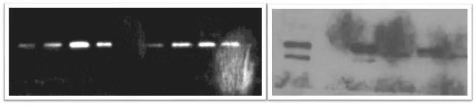 WB实验条带问题？原因分析和解决方法都在这里