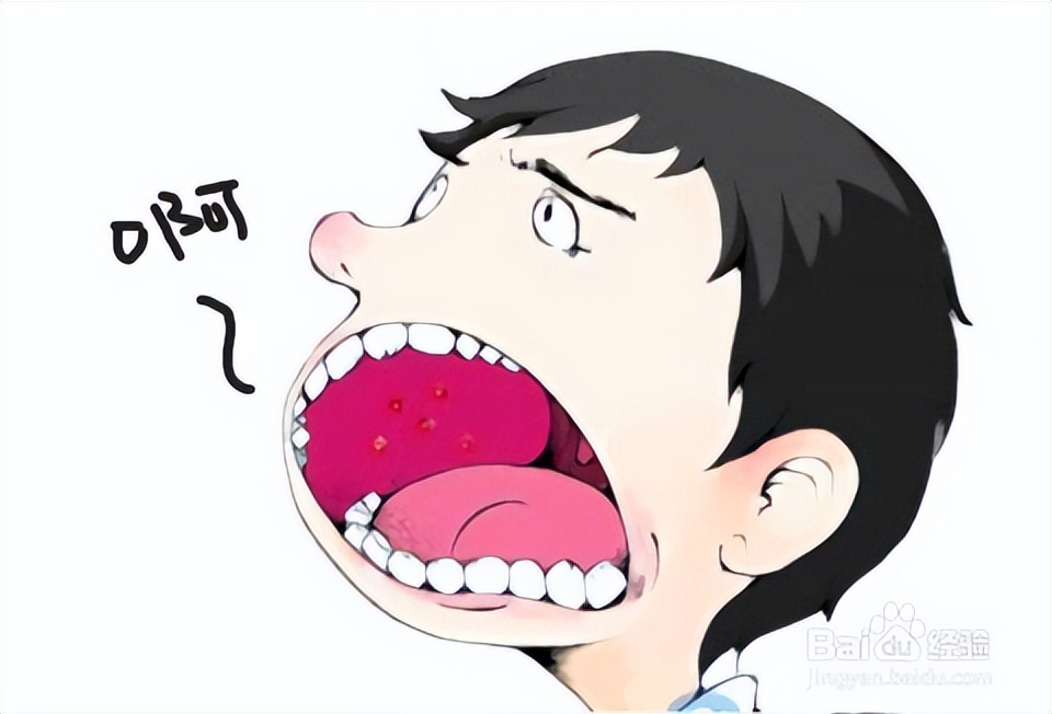 得了口腔炎怎么办,得了口腔疾病一定要及时就医