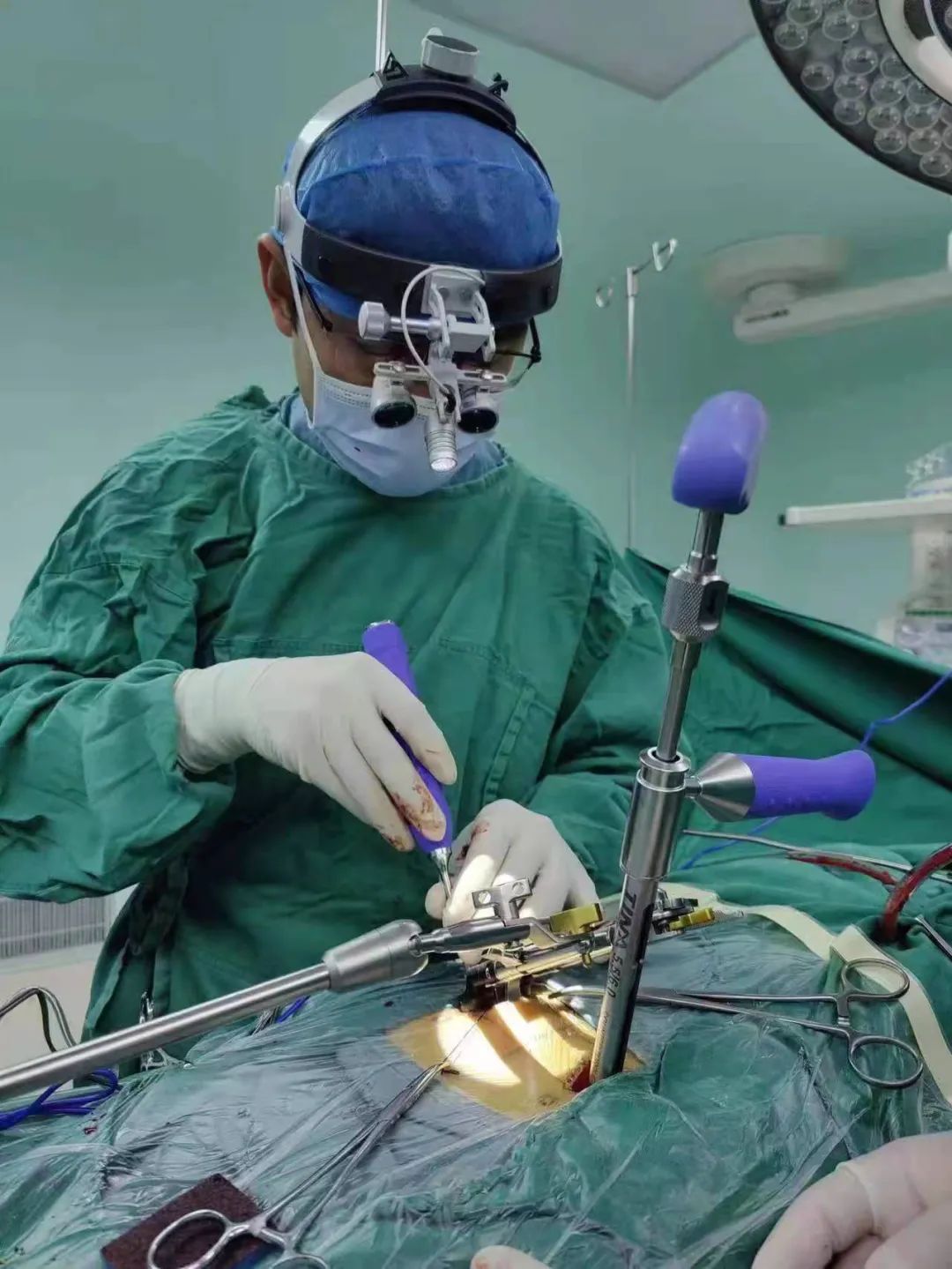 八大处微创小切口,微创技术大全