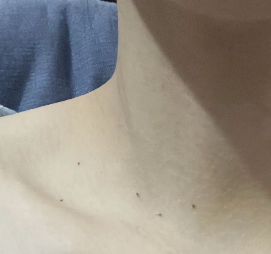 夏天喝的防中暑的药叫啥,夏季酷暑防中暑的药