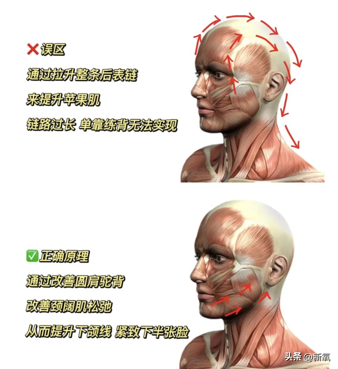 脸胖下垂是什么原因,脸肥下垂