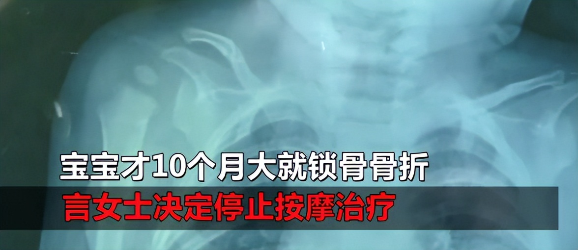 女子胸部锻炼出乳腺炎,女子保养胸部