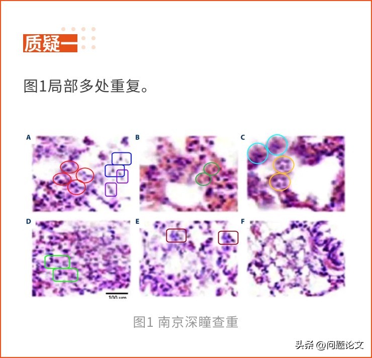 来自山东、湖北、江苏及辽宁等地医院的5篇论文竟都存在图片重复