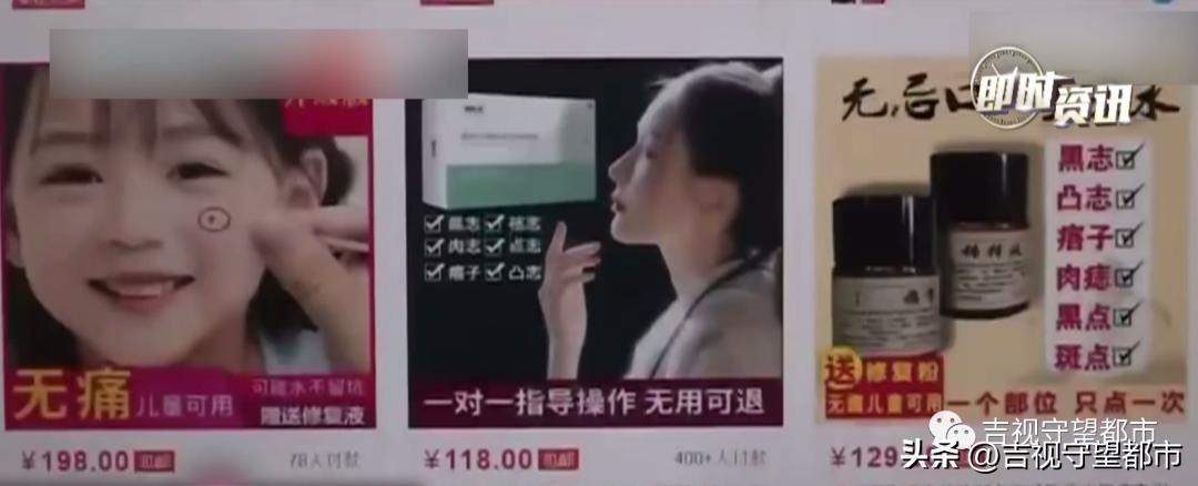 激光祛痣和药水点痣哪个好,祛痣无痛药水