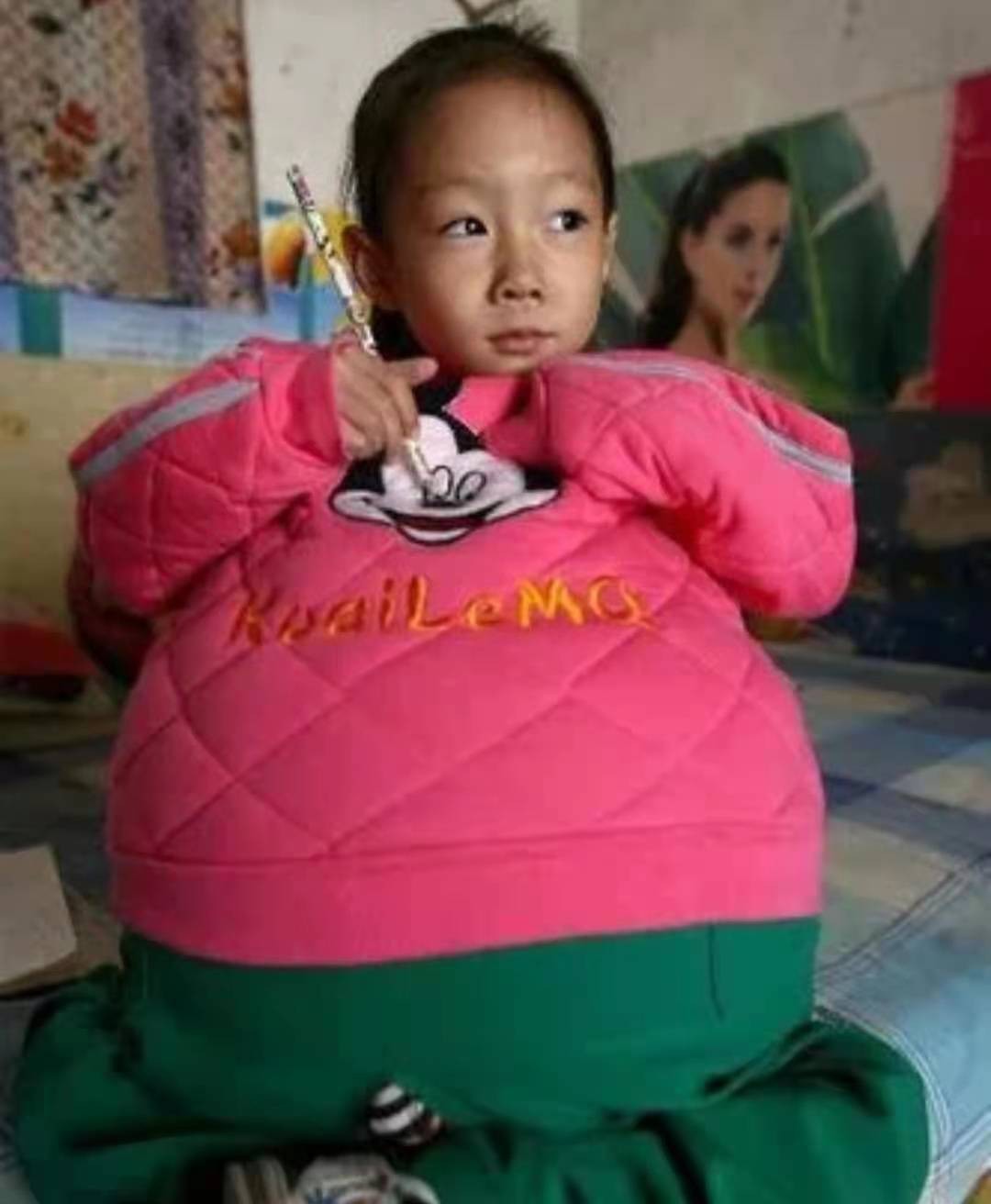 2010年一位山西4岁女童得“怪病”，肚子宽106厘米，后来治好了吗