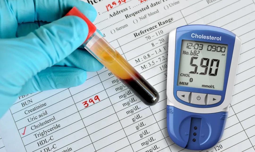 腿上出现斑点是糖尿病的前兆吗,糖尿病人腿上出现糖斑图片