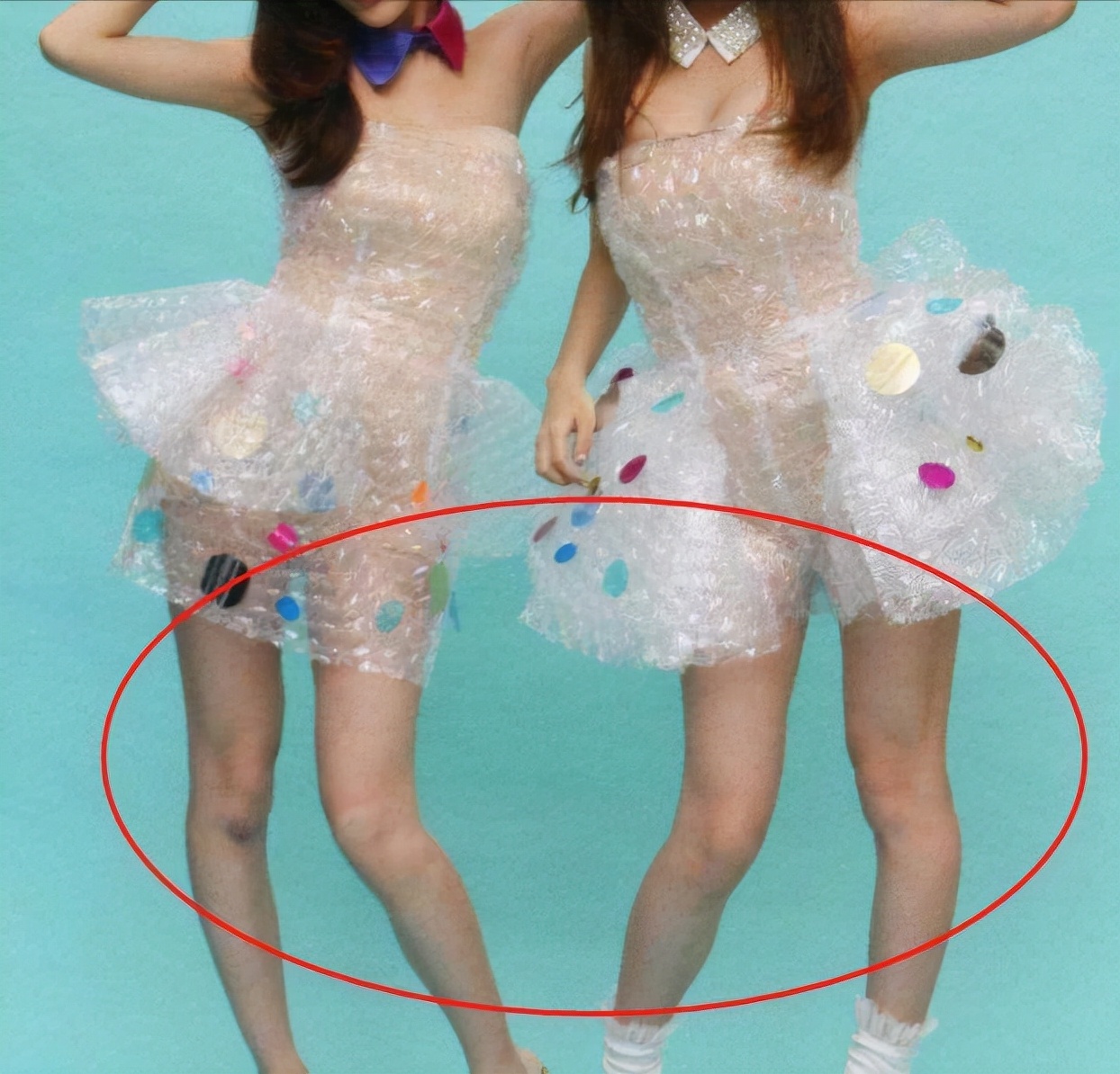 给新生儿绑腿科学吗,宝宝晚上绑腿睡觉能矫正腿型吗