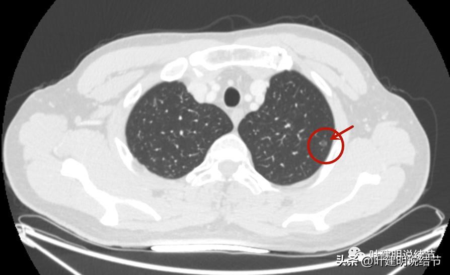 医生为了预防医患矛盾过度诊疗,医院过度医疗手术