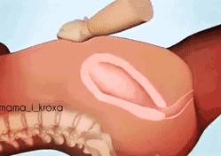 医生把胎盘拿走了,21天胎盘留体内