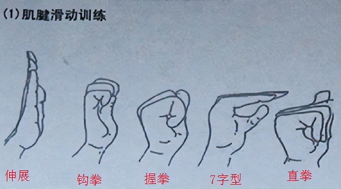 手部麻木怎么办,手部麻木吃什么药好