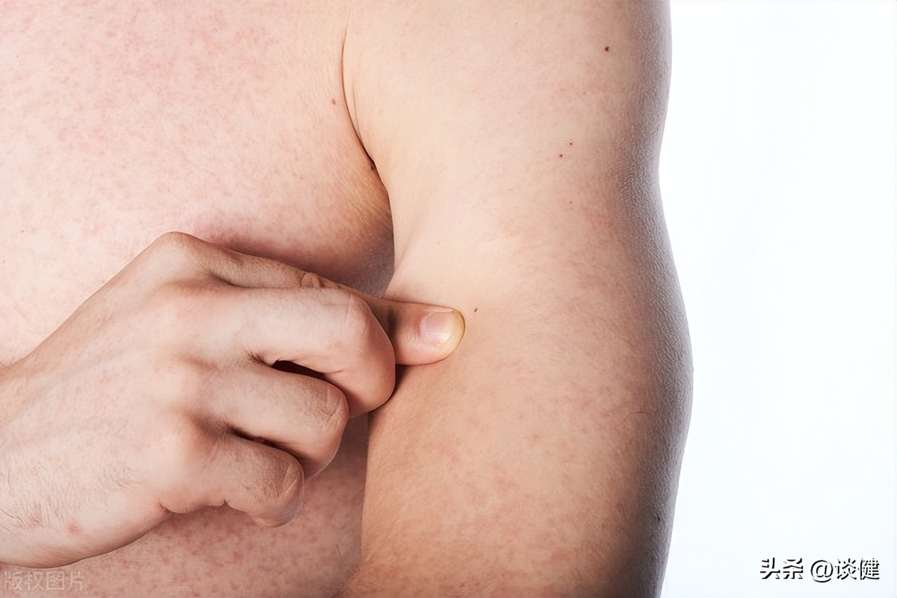 肛门周围潮湿瘙痒能用盐水清洗吗,肛门潮湿瘙痒时不时的流出分泌液