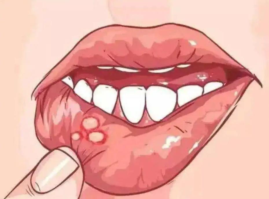 别把艾滋病当皮肤病,别错把艾滋当成皮肤病