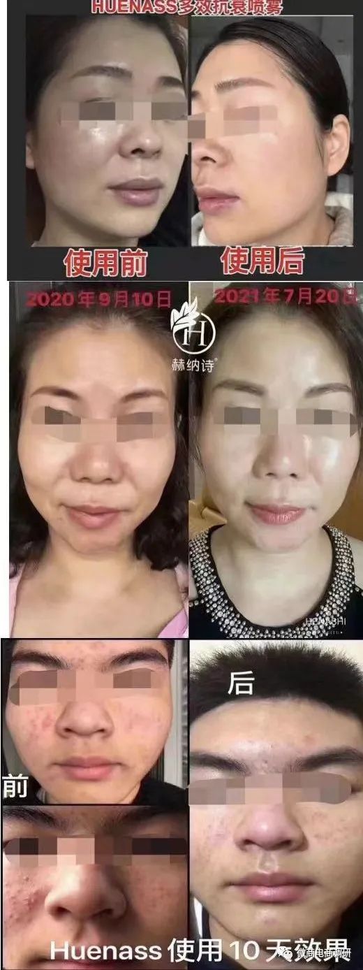 赫纳诗是真还是假,赫纳诗到底是真的吗