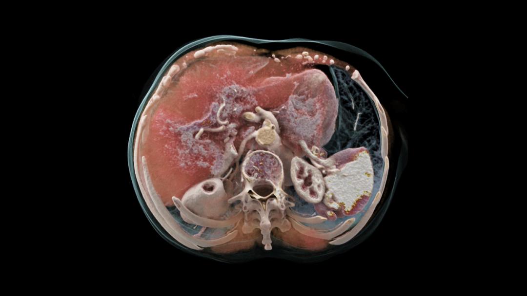 美国最新治疗肺癌特效药,治疗癌症需要的工具