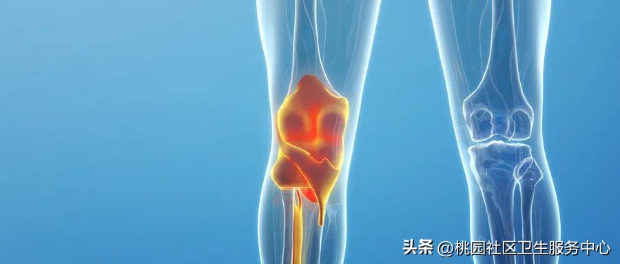 天气转暖腿反而痛得厉害,天气一冷腿关节疼