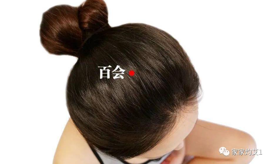 艾灸为何能调百病,艾灸百会穴有血冲顶的感觉