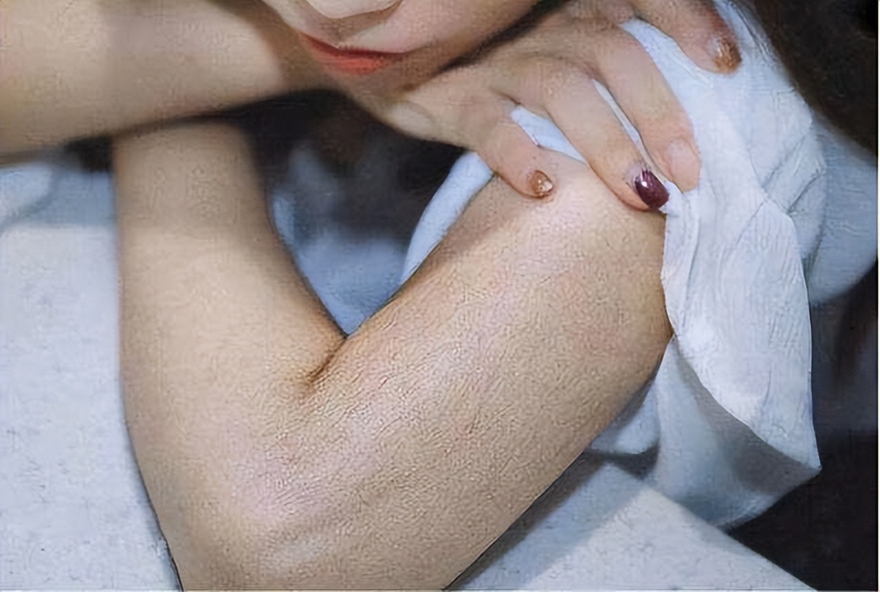 为什么有的女性体毛旺盛,有的却“光秃秃”?看完涨知识了