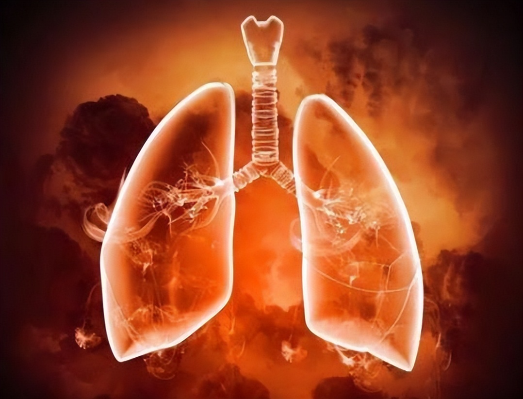 肺火不吃药能好吗,肺火不旺怎么办