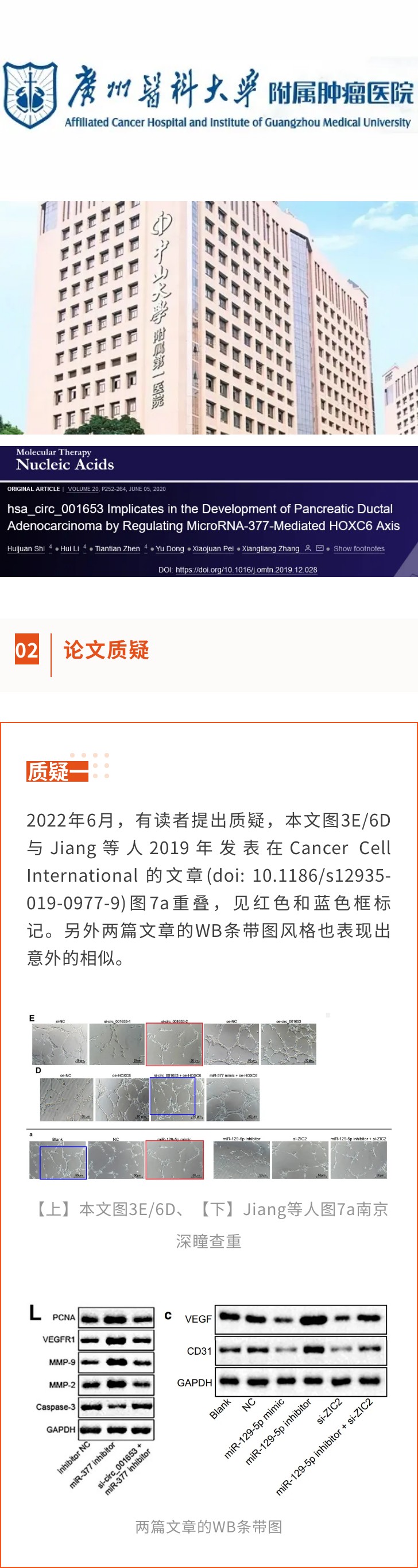 广州医科大学附属肿瘤医院、中山一院联合发表的高分论文被质疑