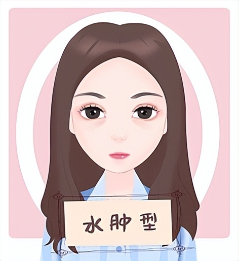 眼袋的10种症状,眼袋的类型包括哪五个