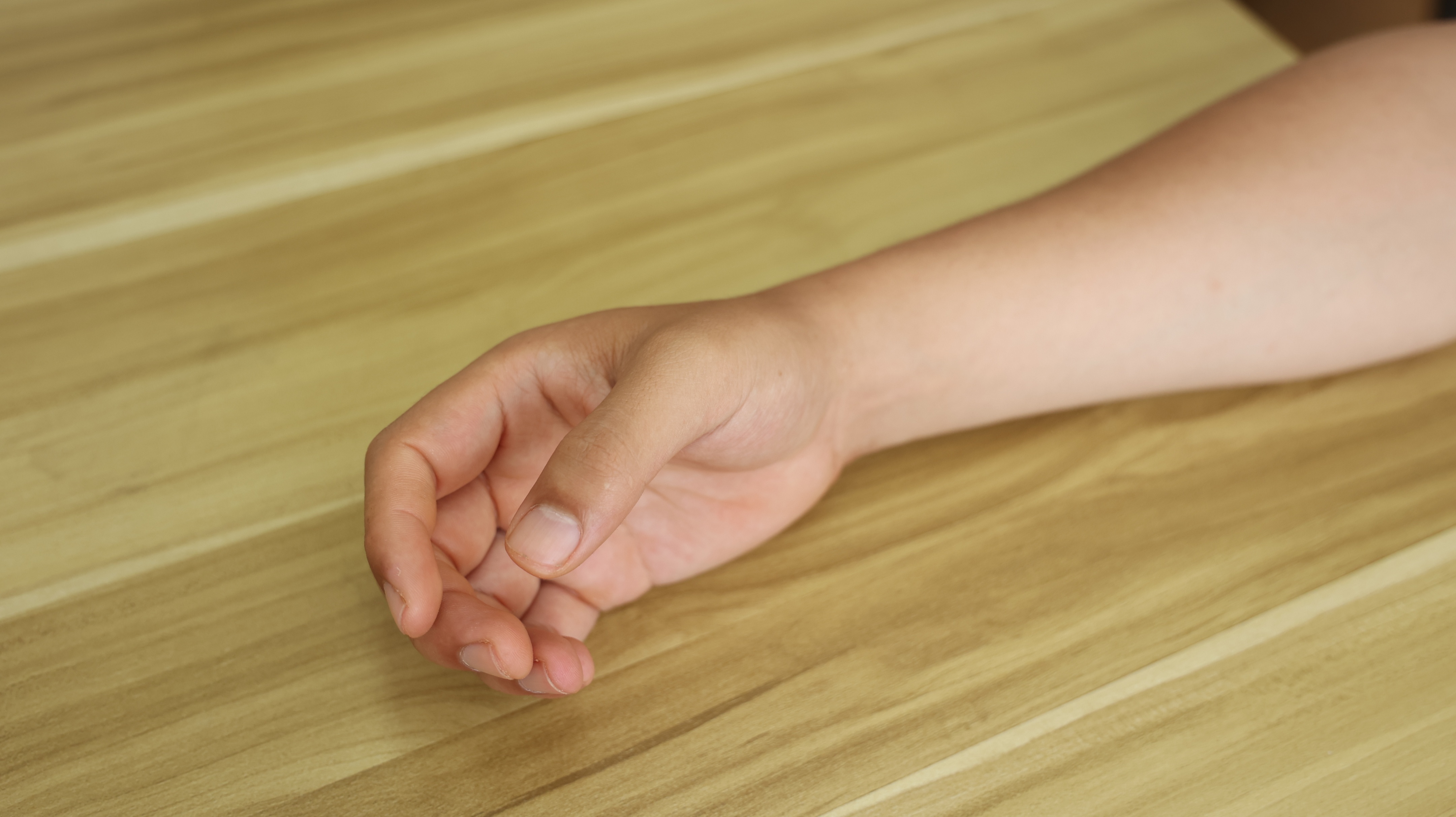 血糖高的人身体发痒怎么治,哪个地方发痒证明血糖偏高了