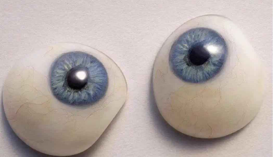 为什么戴义眼后分泌物增多了，该怎么办？