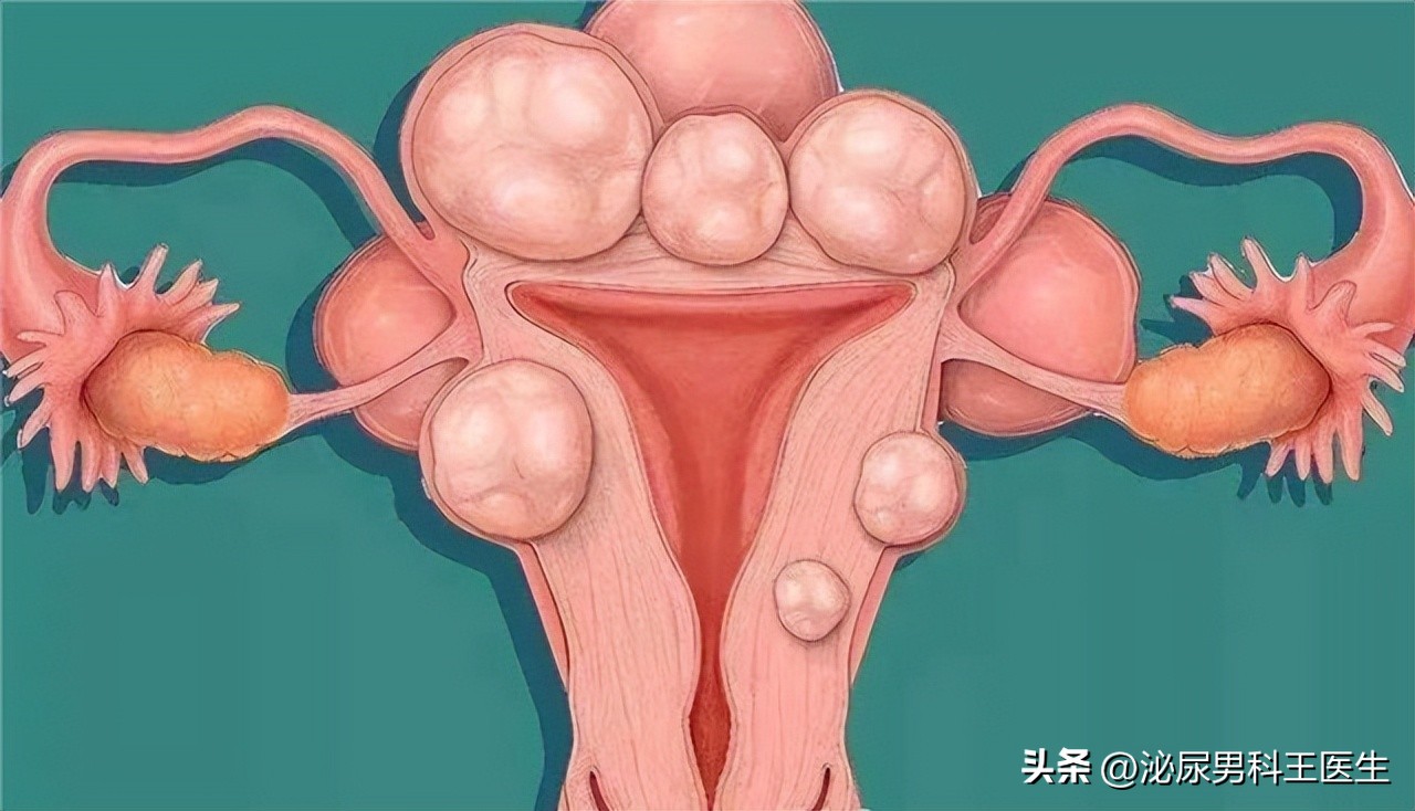 节育环多大年龄取出好取,节育环一直不摘