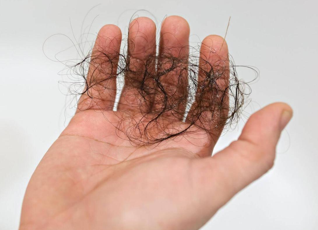 为什么有人“下面”没毛？女性*处私**毛发的4个作用，别羞于了解