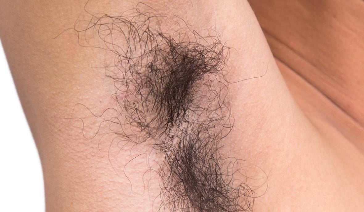 为什么头发眉毛都是直的，阴毛却是卷的？医生一次性说个明白