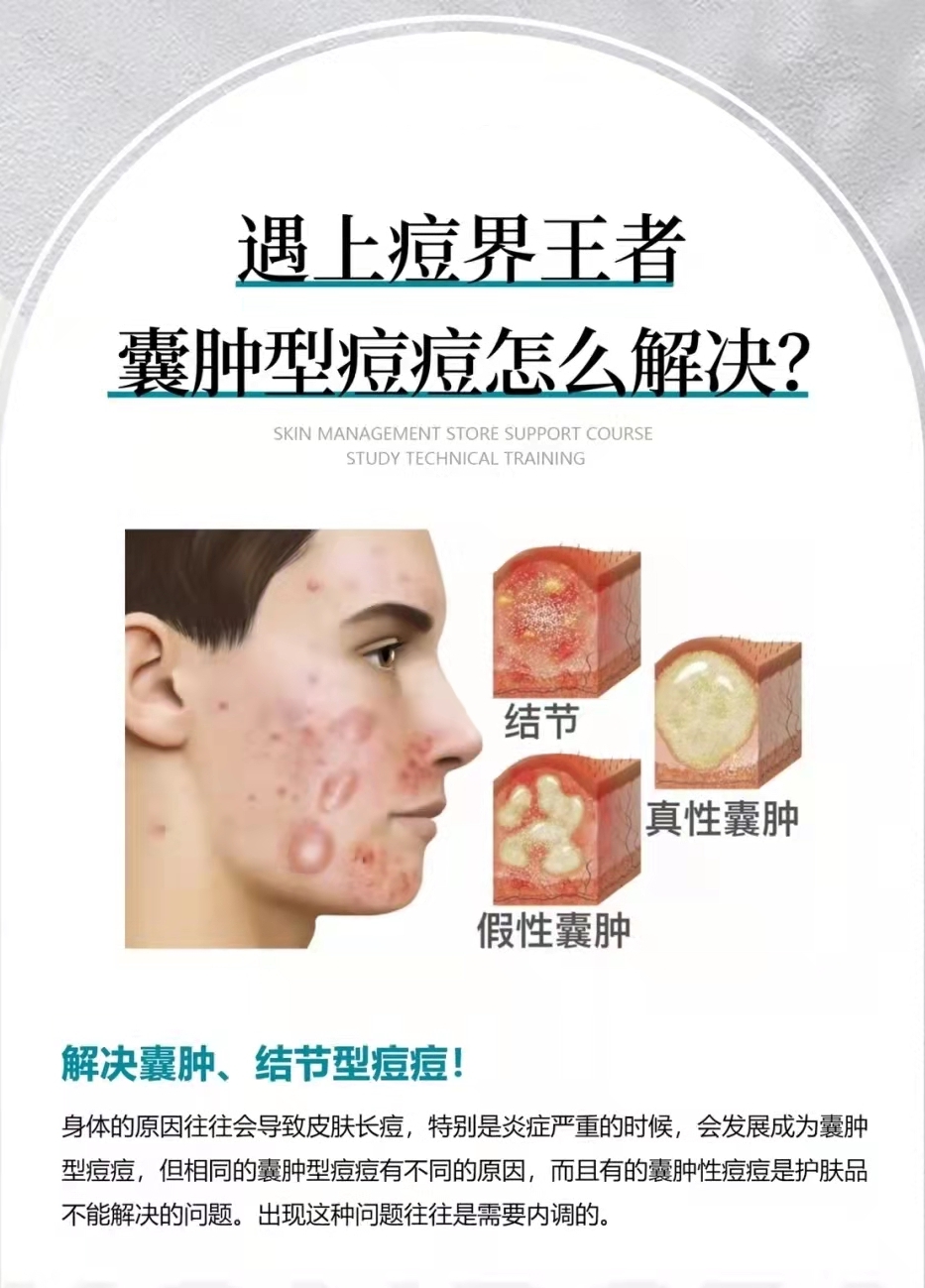 结节性痘痘怎么防止长痘坑,痘痘要变成痘坑了该怎么办