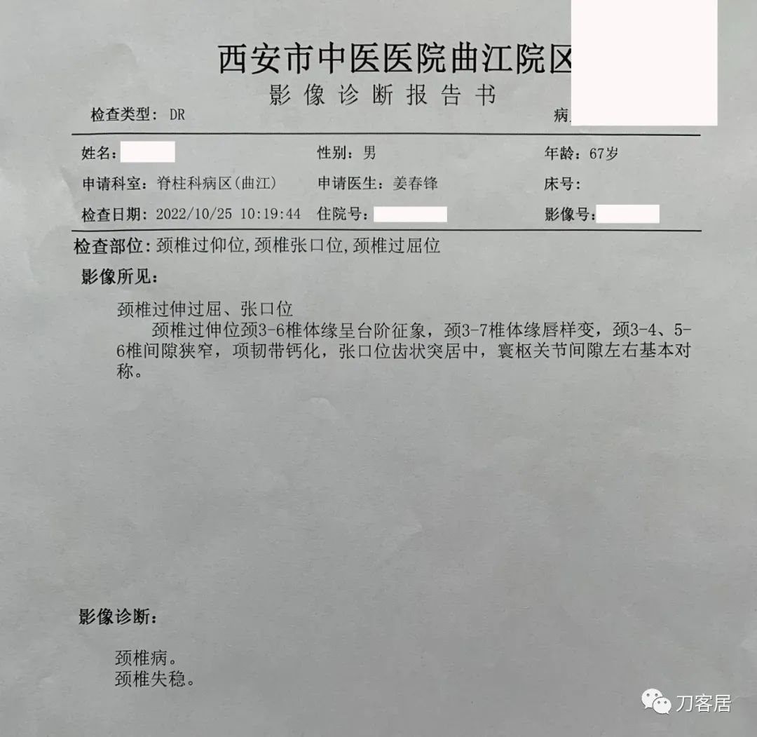 又是颈椎病，又是腰椎滑脱，又是骶管囊肿，多家医院就诊...