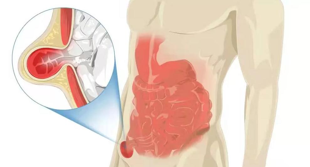 人体无用的6种器官是什么,人体最鸡肋的器官