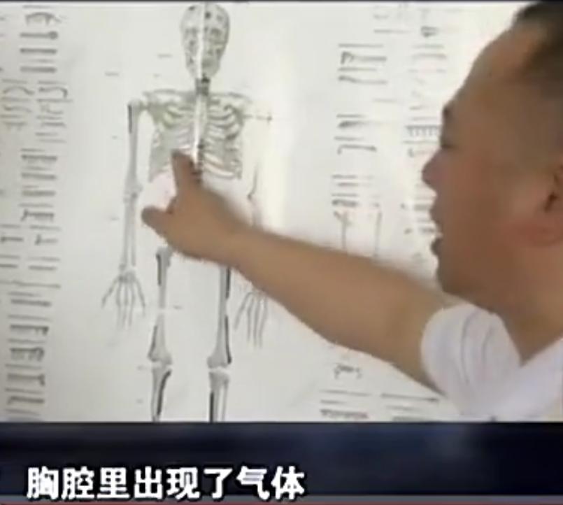 江苏植物人怀孕生子现状,江苏植物人昏迷三个月发现怀孕