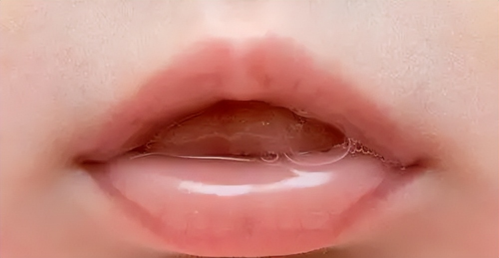 晚上睡觉嘴巴发干是什么原因呢,晚上睡觉嘴巴总是发干是什么原因