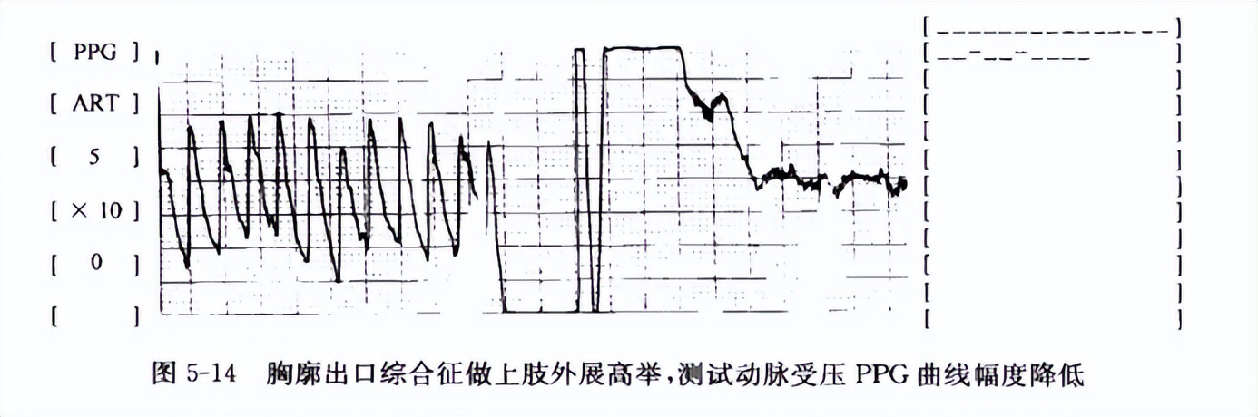有关血管外科学的书推荐,血管外科临床解剖学第2版