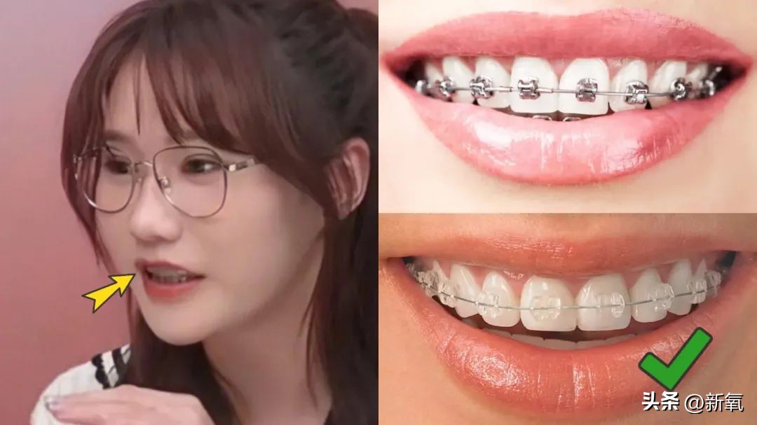 扒一扒旺旺的变美小技巧and搞钱能力