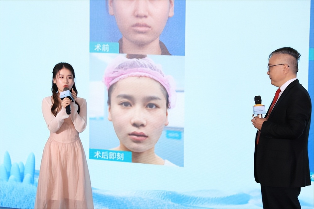 广州整形美容医院紫馨,广州紫馨整形医院线雕