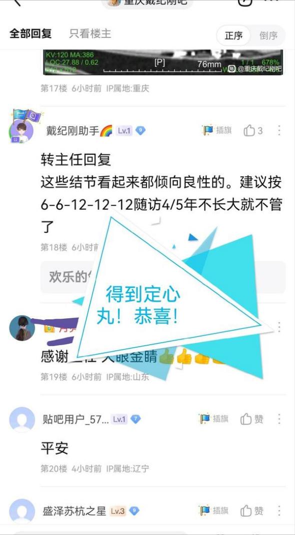 从肺结节到磨玻璃结节是怎么回事,0.6-0.65cm磨玻璃结节需要手术吗