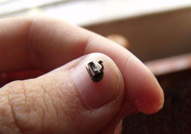 明明很小心却还是出问题,托槽如果频繁掉有哪些方案