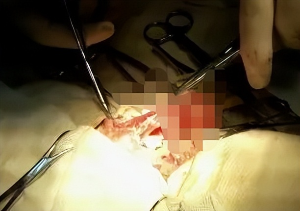 猫咪常见肿瘤有哪些？怎么治疗？