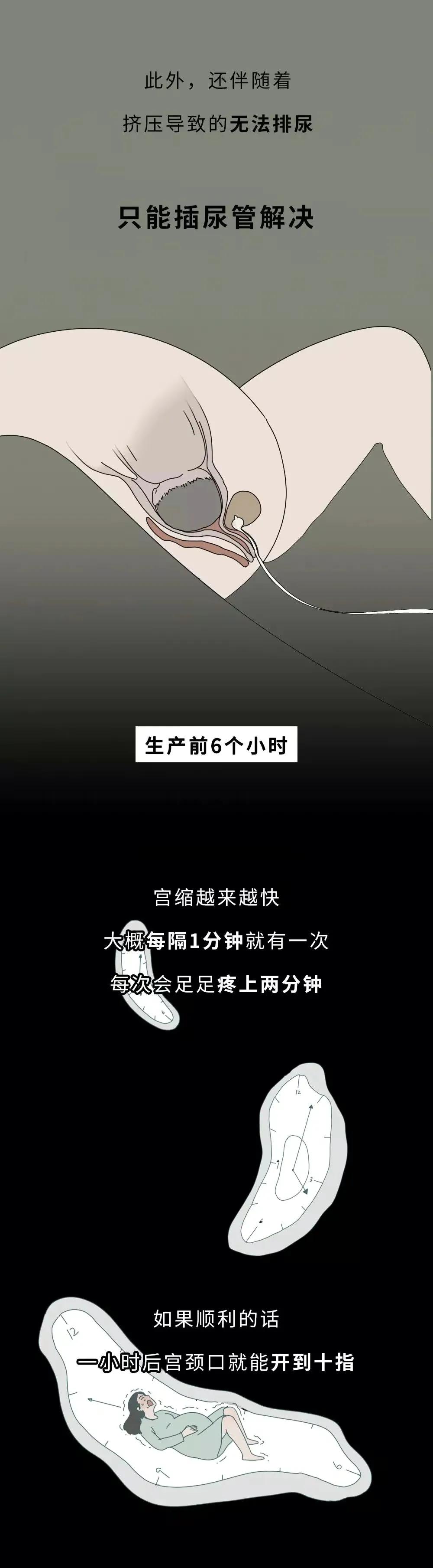 女人生孩子“开十指”全过程曝光，没人能笑着看完