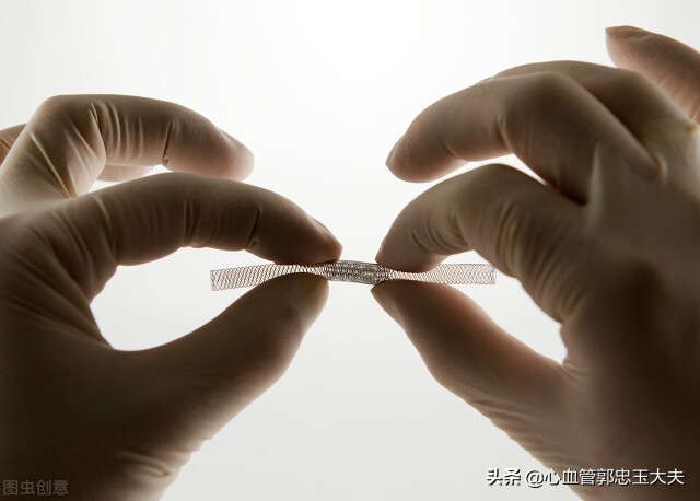 为什么支架内更容易堵,指标正常但支架内再狭窄