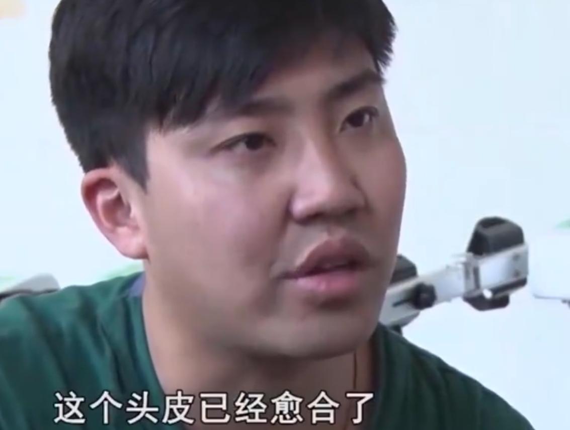 河南男子掉锅烫伤爸妈植皮救儿子,河南男子掉入油锅后续