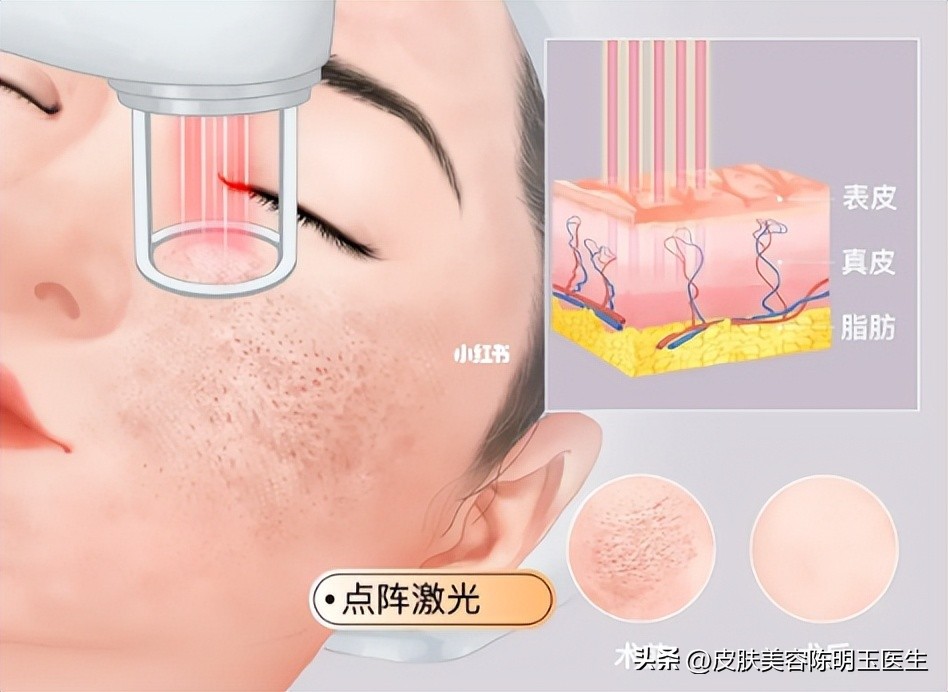 不想吃药有什么方法,不想吃药怎么让皮肤变好