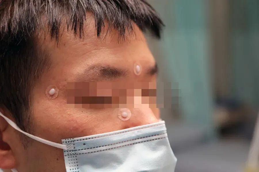 失去嗅觉/头痛/打喷嚏/记忆力衰减……浦东有特色中医门诊，专治这个病！