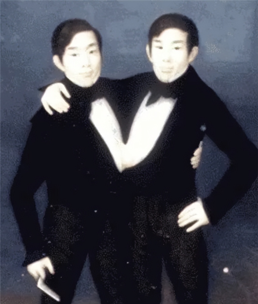 连体兄弟真的存在吗,印度连体兄弟被奉为神灵不想分离